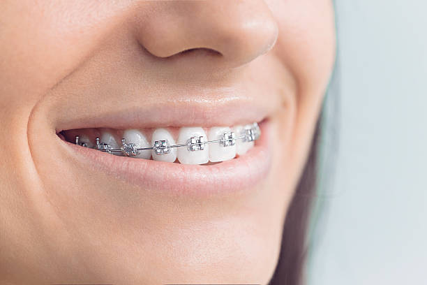 Best Dentures (Full and Partial)  in Deer Park, TX